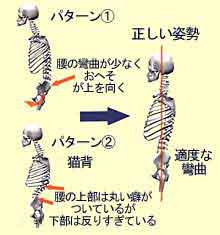 �p�^�[���ʎp���̐}